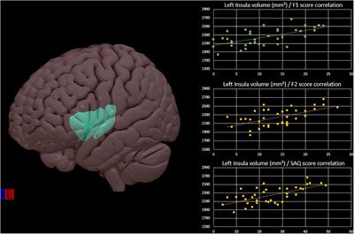 Gender Brain Structural Differences and Interoception